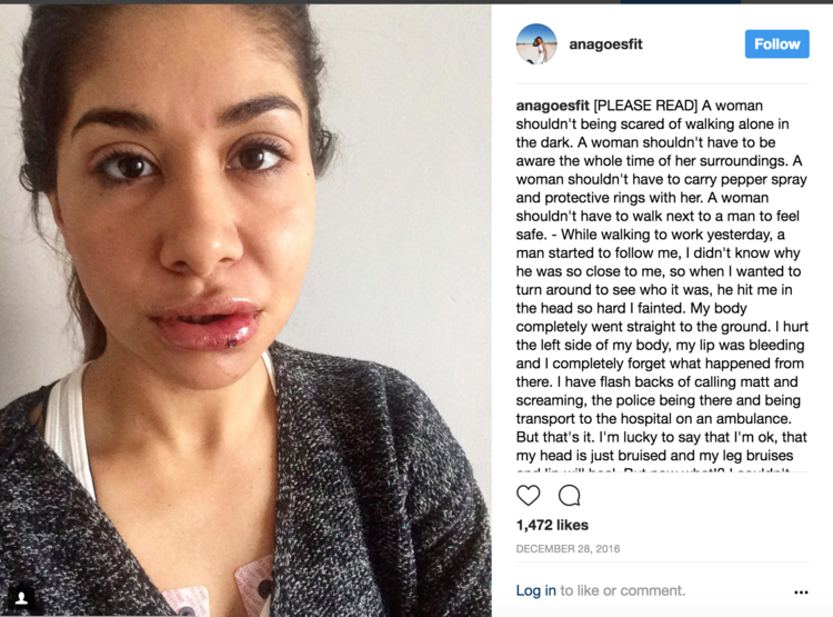 The post Ana shared on her Instagram account to spread awareness about her assault.